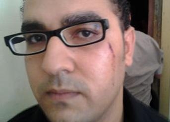 ضابط وعدد من الجنود يعتدون على عضو بالتيار الشعبى المصري