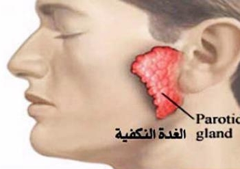 ظهور 29 حالة مصابة بالغدة النكافية بقنا