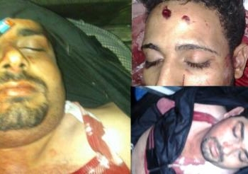جراء اشتباكات “الخصوص 4 قتلى و3 مصابين