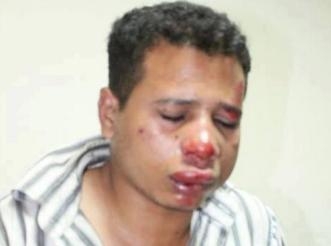 الاعتداء على اثنين من الصحفيين و تهديد الشاب بعد تصويره عاريا