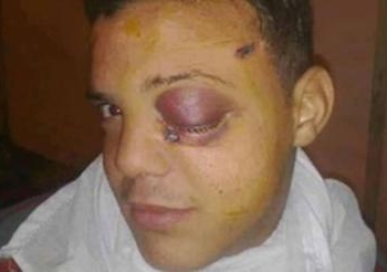 وفاة الناشط باسم محسن متأثرا بإصابته بطلق ناري
