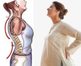 تجبير العظام الاسمنتي احدث علاج لكسور العمود الفقري