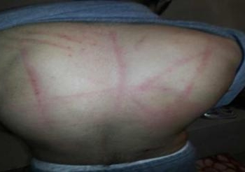 ورشة عمل حول أليات الرصد والتوثيق في قضايا التعذيب بالأسكندرية