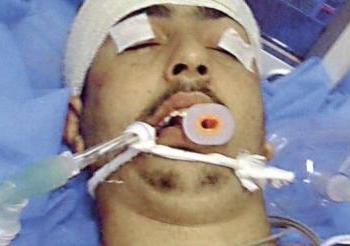 انباء عن عودة سلامة فوزى المصاب من ليبيا