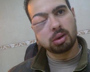مركز حقوقي يرصد حالتي تعذيب علي يد شرطيين في المنيا .. ويطالب الداخلية بسرعة التحقيق واتخاذ خطوات ادارية