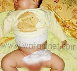 ضحية جديدة من مسلسل الإهمال بمستشفي حوش عيسي 