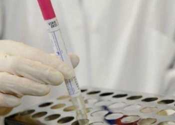 الصحة تعقد مؤتمر صحفي بشأن التفشي الوبائي لفيروس H1N1