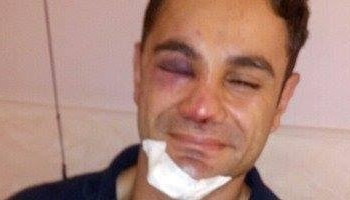 بودى جاردات الشركة المنظمة لحفل”حماقى”يعتدون بالضرب على ضابط بأكتوبر