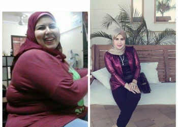 “سلمى” هربت من سخافات المجتمع بعملية تدبيس معدة