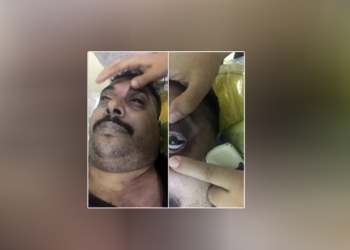 تشريح جثة ماهر جرجس حلاق "بني سويف" الذي أصيب بإعياء أثناء تحرير محضر