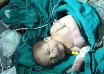 العثور على رضيع ب”القمامة” في شبرا الخيمة