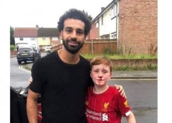 حقيقة صورة محمد صلاح مع الطفل الذي تسيل الدماء من أنفه