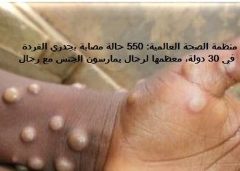 منظمة الصحة العالمية: التفشي العالمي لجدري القردة مثير للقلق