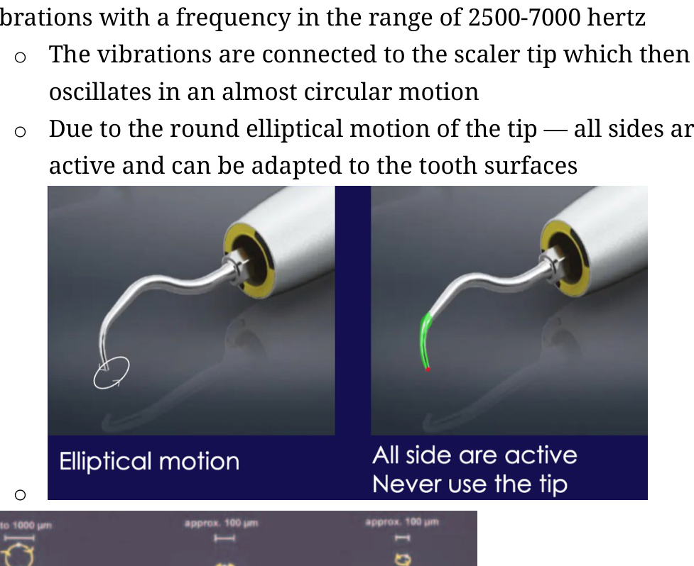 Diagram of scaler tip motion