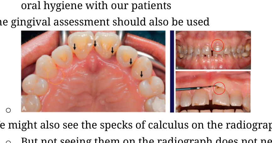 Clinical images of gingival tissue assessment
