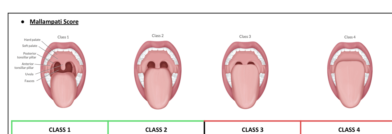Mallampati scoring system