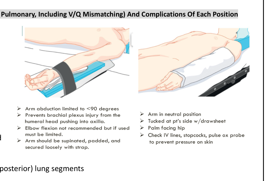 Patient positioning diagram