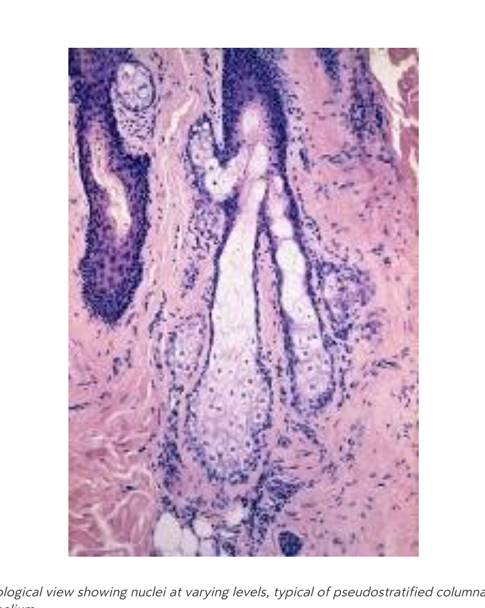Pseudostratified columnar epithelium