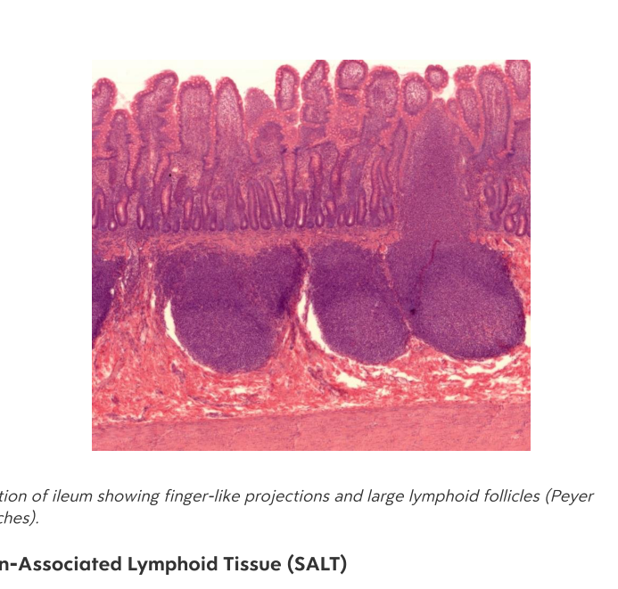 Tonsils and Lymphoid Tissue