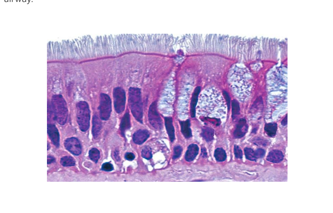 Histology micrograph of ciliated respiratory epithelium