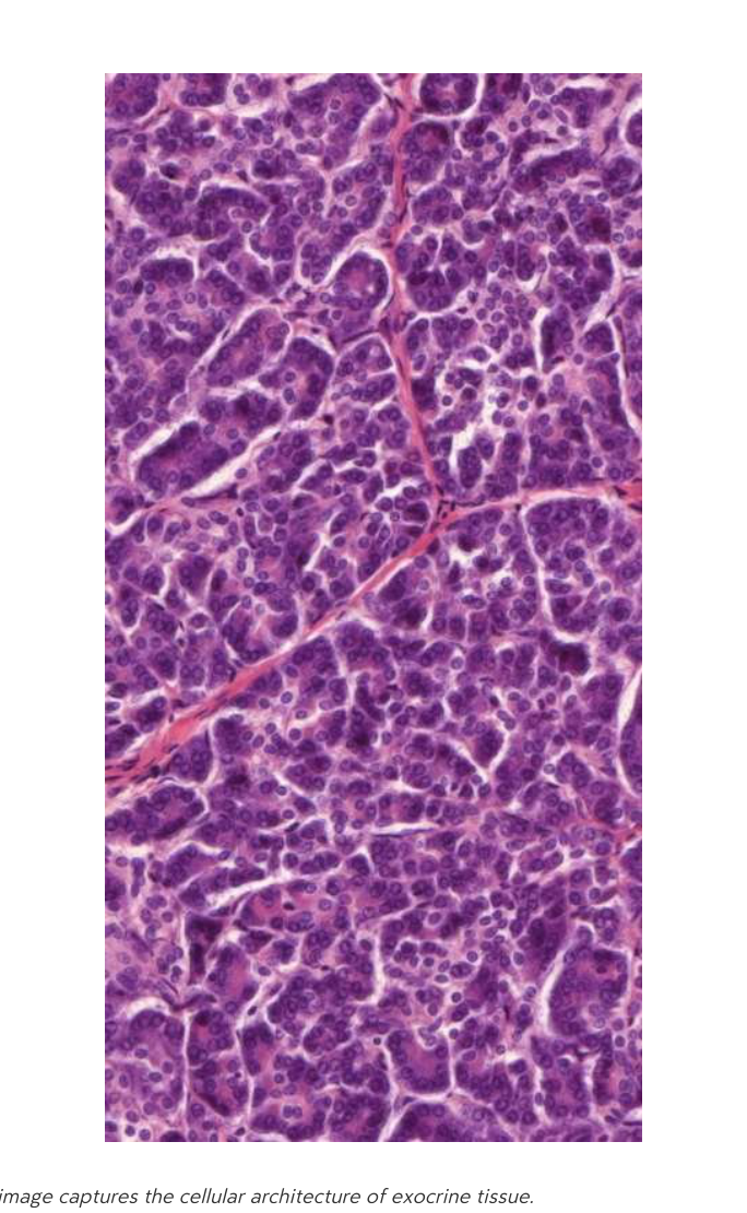 Micrograph of exocrine pancreatic tissue