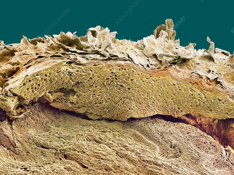 Cross-section of skin