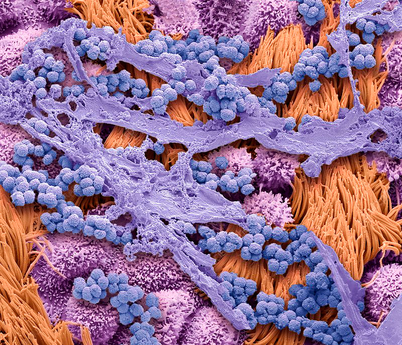 Microscopic view of mucus with bacteria