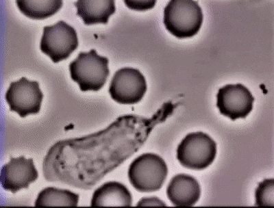 A phagocytic white blood cell engulfing bacteria