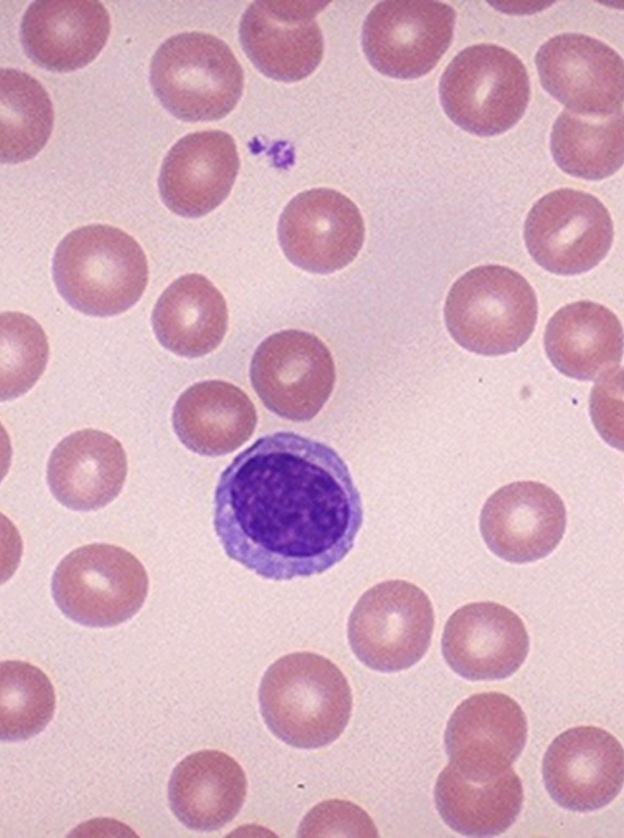 Microscopic view of a lymphocyte
