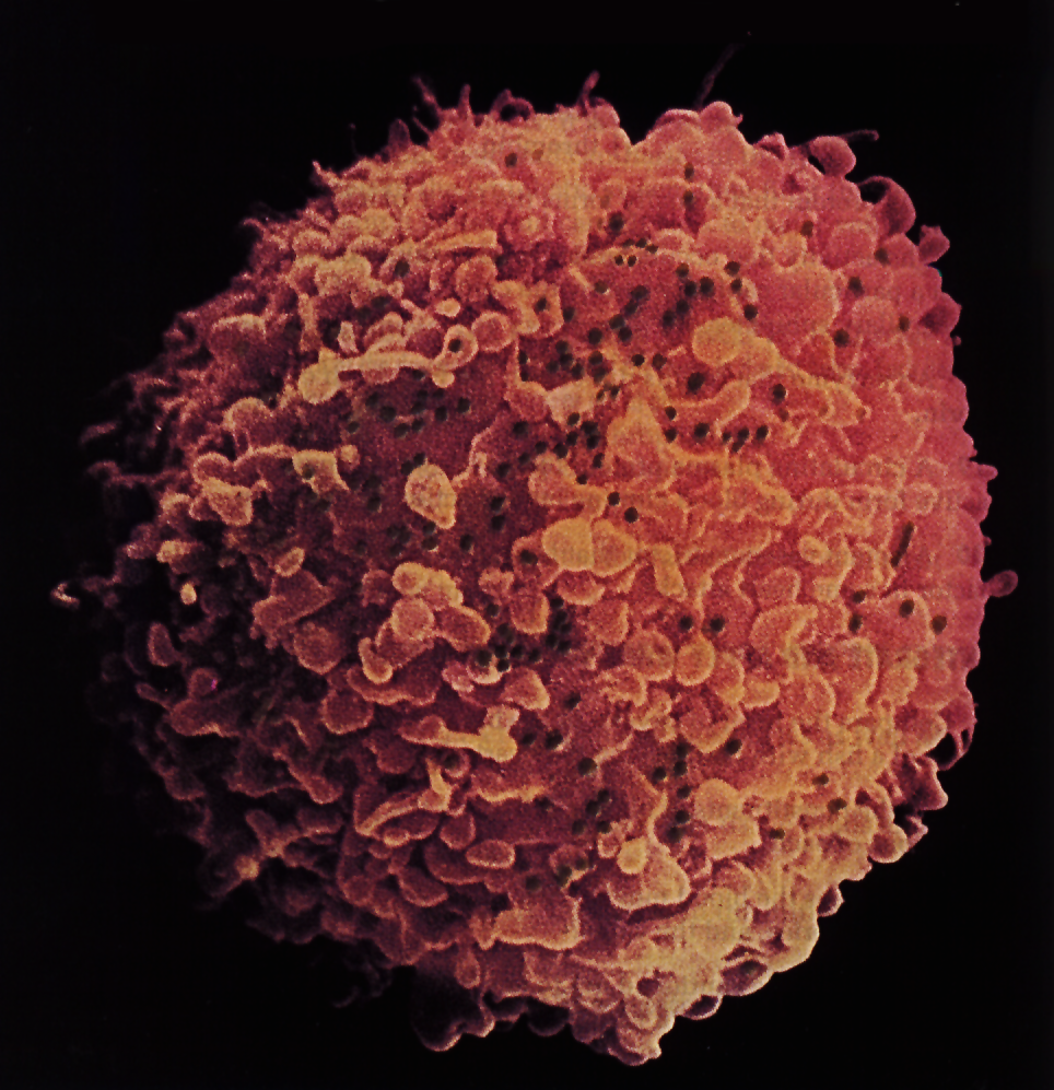 WBC infected by HIV particles