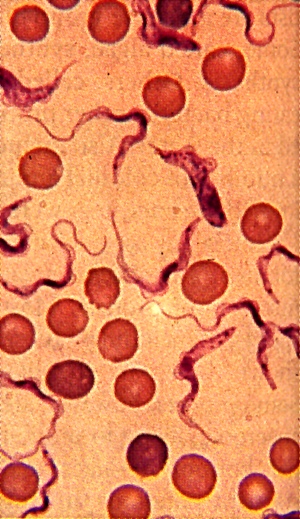 Microscopic view of red blood cells with trypanosomes