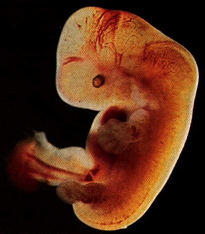 A human fetus.