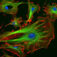 Cells stained with fluorescent markers (immunofluorescence)