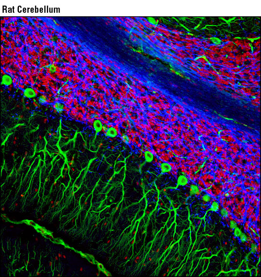 Micrograph of brain tissue showing fluorescently labeled neurons and glial cells.