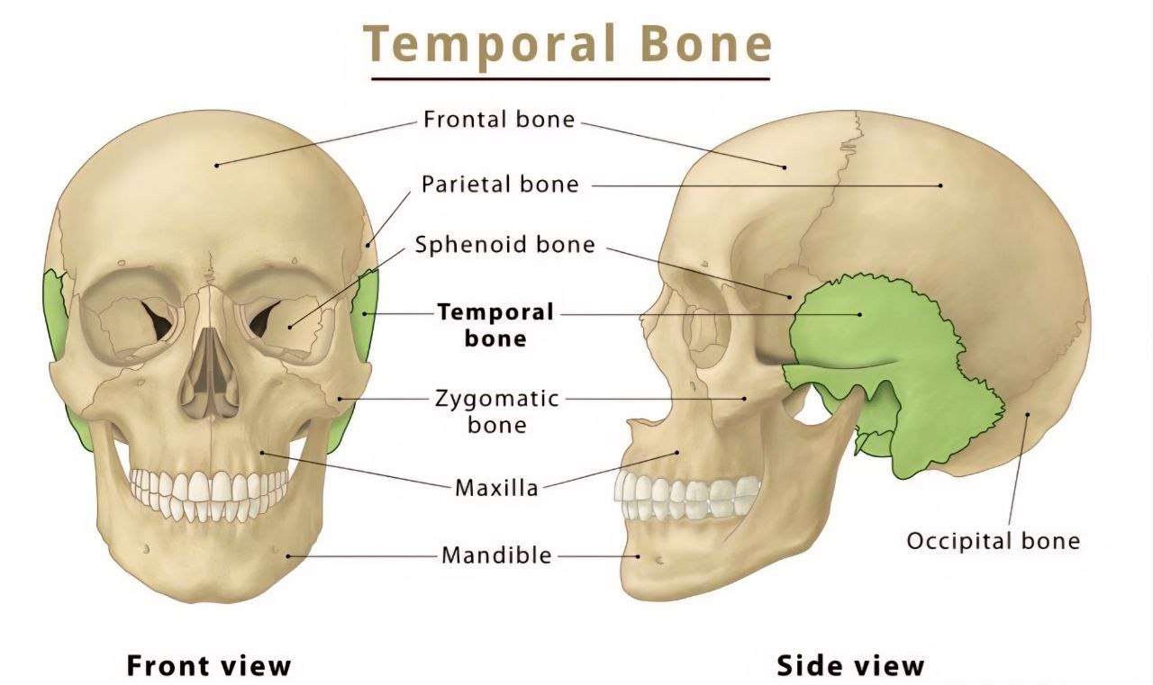 image of human skull with highlighted temporal bone