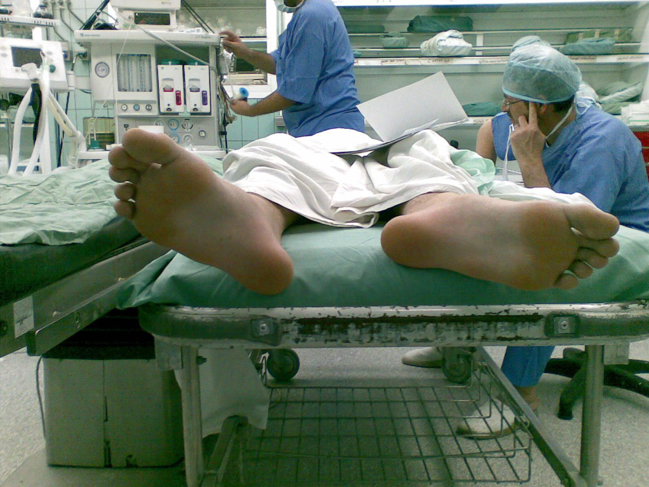 deformity photo