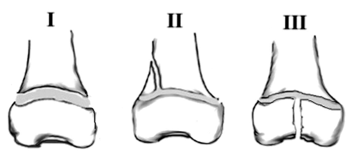 AO principles diagram