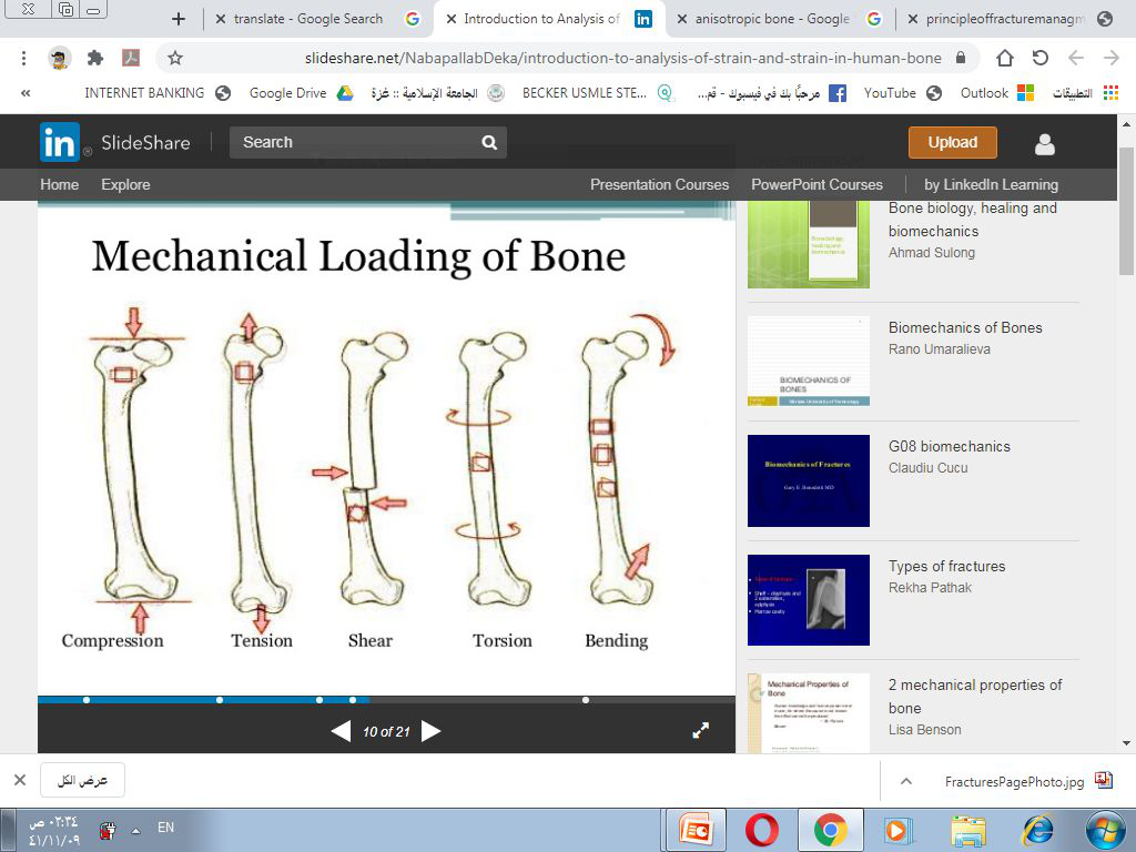 Diagram illustrating different types of mechanical loading on bone: Compression, Tension, Shear, Torsion, Bending