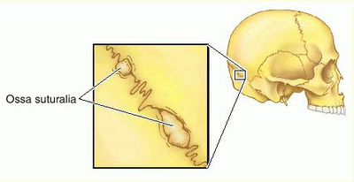 Sutural Bones