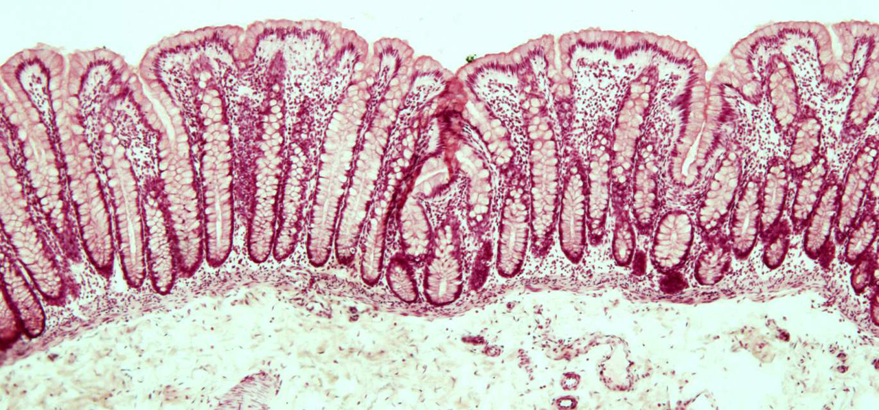 Colon: villi och kryptor Colon: villi och kryptor