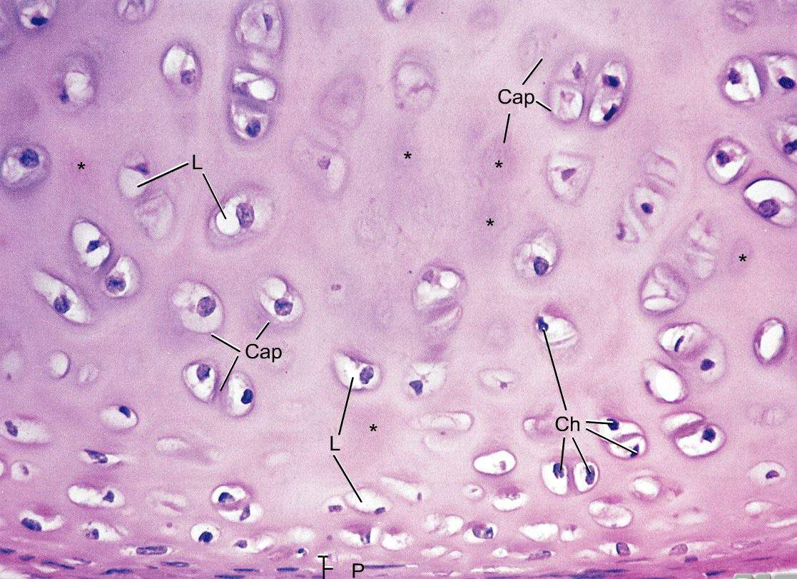 Histological image of hyaline cartilage showing chondrocytes in lacunae