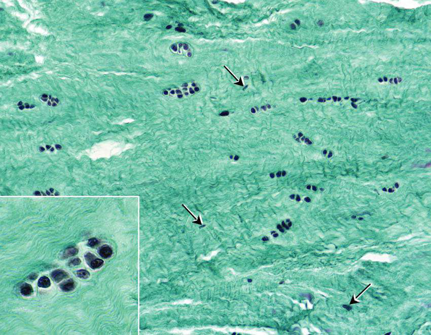 Microscopic view of fibrous cartilage with arrows pointing to cellular structures and collagen fibers
