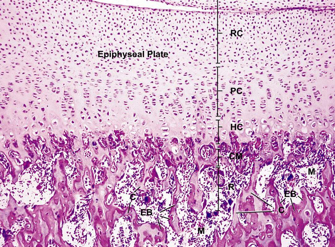 Microscopic view of the epiphyseal plate