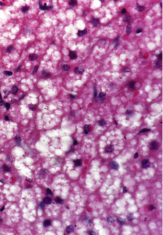 Microscopic view of adipocytes in brown adipose tissue.