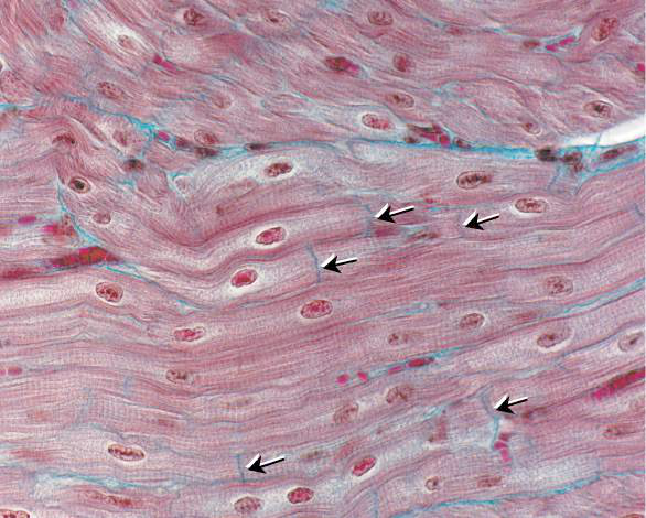 Micrograph of cardiac muscle tissue showing branched cells with labels for 'intercalated discs', central nuclei, and striations
