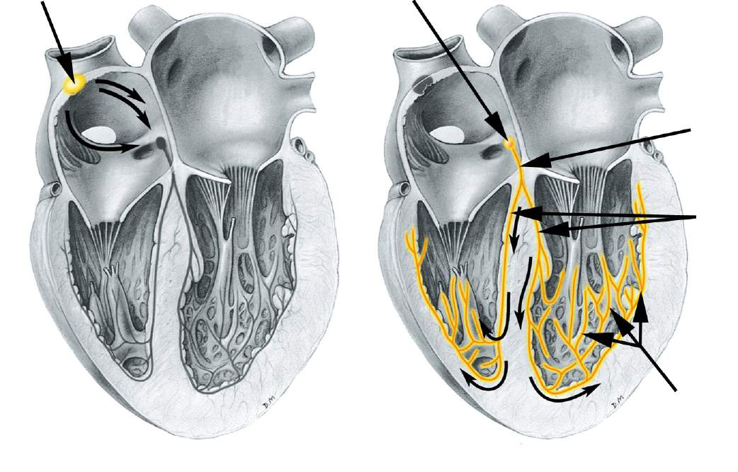 Diagram of the heart's conduction system showing the SA node, AV node, Bundle of His (atrioventricular bundle), right and left bundle branches, and Purkinje fibers
