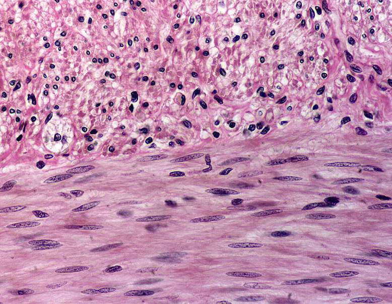 Micrograph of smooth muscle tissue showing elongated cells with centrally located nuclei