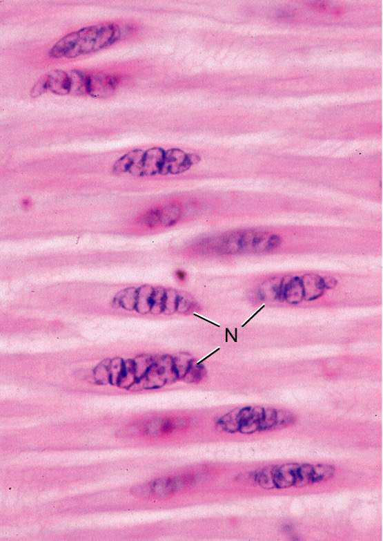 micrograph