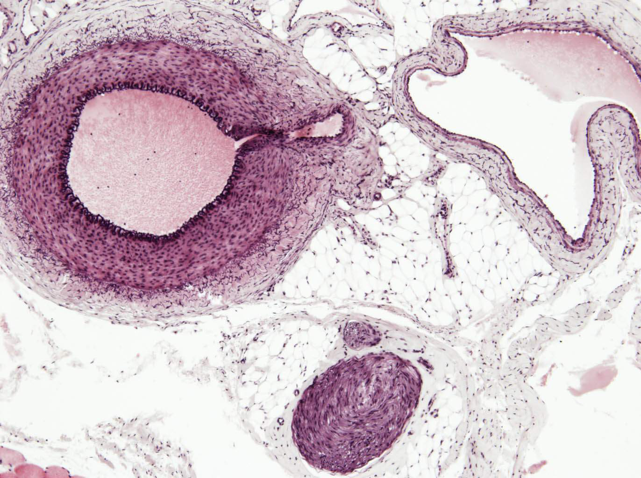 Histologisk bild: artär, ven och nerv