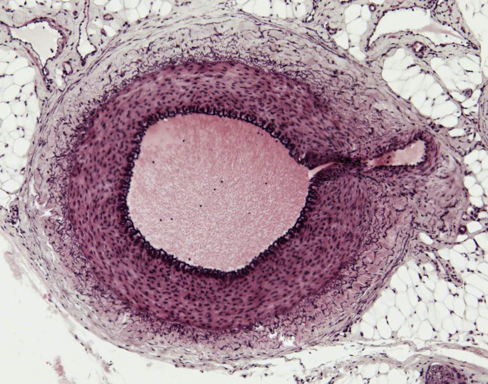 histologisk bild av ett kärl
